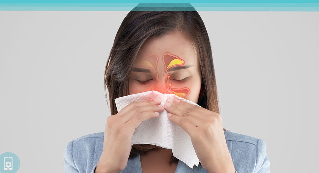 Sinusitis: Descubriendo Tratamientos Naturales y Saludables